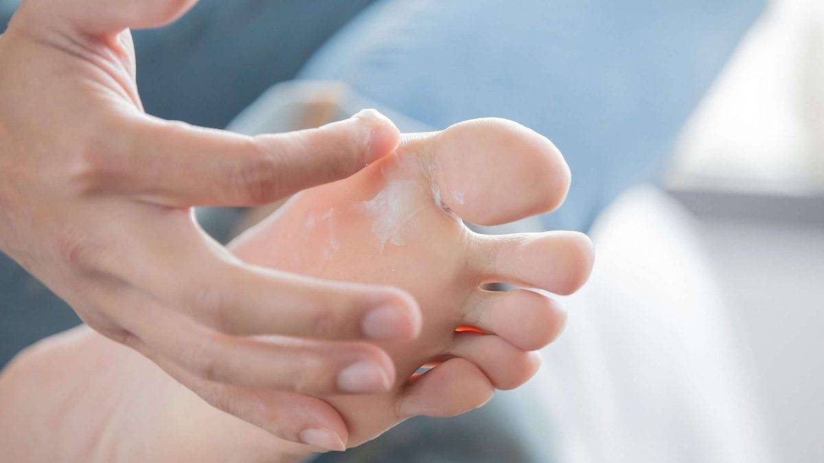 brilliant-at-home-recipe-for-an-ointment-against-annoying-athlete-s-foot-de-1