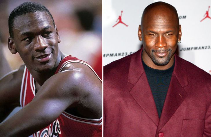 Photos of 20 Bald Celebrities When They Had Hair_1