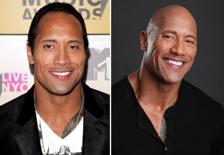 Photos of 20 Bald Celebrities When They Had Hair_10