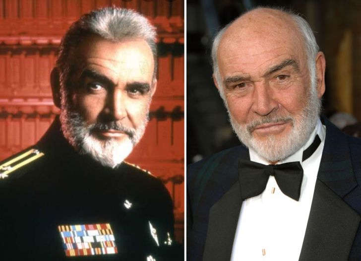 Photos of 20 Bald Celebrities When They Had Hair_11