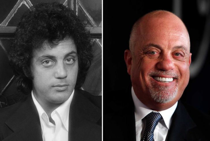 Photos of 20 Bald Celebrities When They Had Hair_12