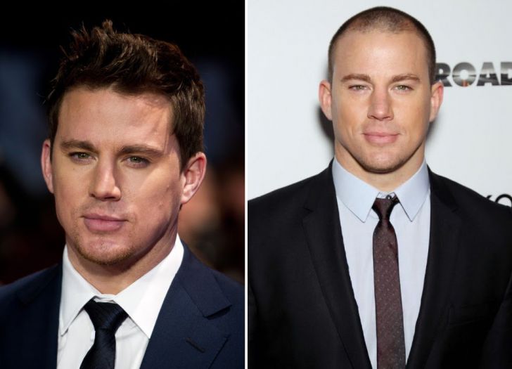 Photos of 20 Bald Celebrities When They Had Hair_15