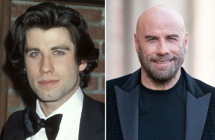 Photos of 20 Bald Celebrities When They Had Hair_2