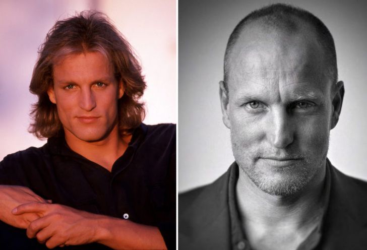 Photos of 20 Bald Celebrities When They Had Hair_20