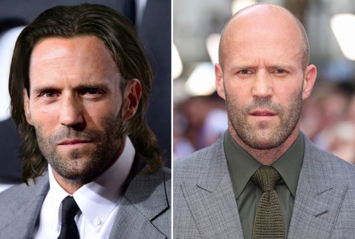 Photos of 20 Bald Celebrities When They Had Hair_8
